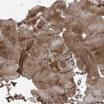 RNF214 Antibody in Immunohistochemistry (Paraffin) (IHC (P))
