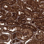RNF214 Antibody in Immunohistochemistry (Paraffin) (IHC (P))