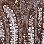 RNF214 Antibody in Immunohistochemistry (Paraffin) (IHC (P))