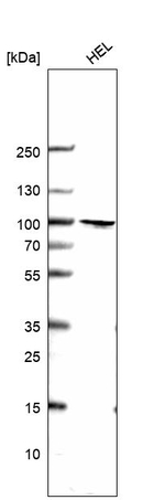 RNF214 Antibody in Western Blot (WB)