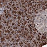 NUDT22 Antibody in Immunohistochemistry (Paraffin) (IHC (P))