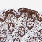 PPTC7 Antibody in Immunohistochemistry (Paraffin) (IHC (P))