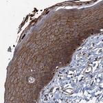 N4BP2L2 Polyclonal Antibody