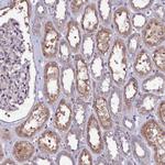 USPL1 Antibody in Immunohistochemistry (Paraffin) (IHC (P))
