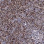 DCUN1D2 Antibody in Immunohistochemistry (Paraffin) (IHC (P))