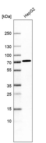 ACSS3 Antibody in Western Blot (WB)