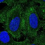 SPERT Polyclonal Antibody