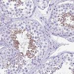 SPERT Antibody in Immunohistochemistry (IHC)