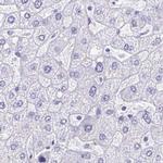 SPERT Antibody in Immunohistochemistry (IHC)