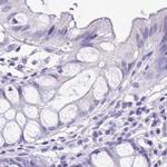 SPERT Antibody in Immunohistochemistry (IHC)