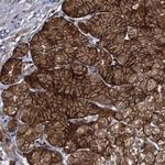 FAM214A Polyclonal Antibody