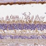 SLC24A1 Antibody in Immunohistochemistry (IHC)