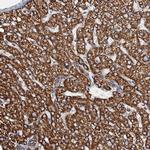 AAGAB Antibody in Immunohistochemistry (Paraffin) (IHC (P))