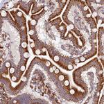 SI-CLP Polyclonal Antibody