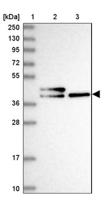 SI-CLP Antibody in Western Blot (WB)