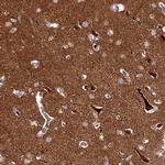 DMXL2 Antibody in Immunohistochemistry (IHC)