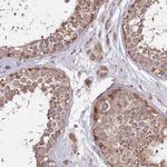 DMXL2 Antibody in Immunohistochemistry (IHC)