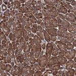 CKAP5 Polyclonal Antibody