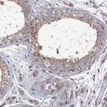 LRRC28 Antibody in Immunohistochemistry (IHC)