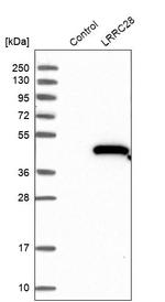 LRRC28 Antibody in Western Blot (WB)
