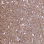 SH3GL3 Antibody in Immunohistochemistry (Paraffin) (IHC (P))