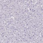 SH3GL3 Antibody in Immunohistochemistry (Paraffin) (IHC (P))