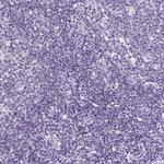 SH3GL3 Polyclonal Antibody