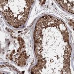 CEP192 Antibody in Immunohistochemistry (Paraffin) (IHC (P))