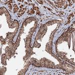 CEP76 Polyclonal Antibody