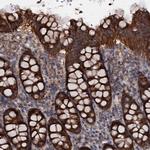 MRPL42 Antibody in Immunohistochemistry (Paraffin) (IHC (P))