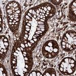 CDAN1 Antibody in Immunohistochemistry (Paraffin) (IHC (P))