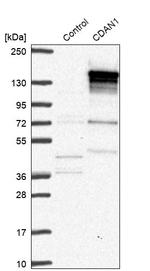 CDAN1 Antibody in Western Blot (WB)