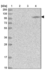 MOCOS Antibody in Western Blot (WB)