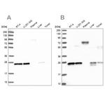 MESDC2 Antibody in Western Blot (WB)