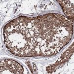 TEX9 Antibody in Immunohistochemistry (Paraffin) (IHC (P))