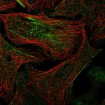 SPRYD3 Polyclonal Antibody