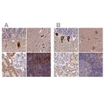 SPRYD3 Antibody in Immunohistochemistry (IHC)