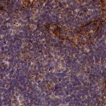 SPRYD3 Antibody in Immunohistochemistry (IHC)