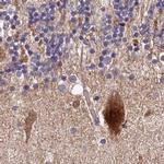 SPRYD3 Antibody in Immunohistochemistry (IHC)