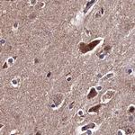 SPRYD3 Antibody in Immunohistochemistry (IHC)