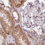 SPRYD3 Antibody in Immunohistochemistry (IHC)