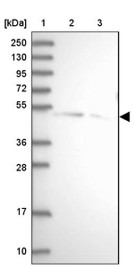SPRYD3 Antibody in Western Blot (WB)