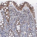 RASSF9 Antibody in Immunohistochemistry (IHC)