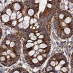 SUCLA2 Antibody in Immunohistochemistry (IHC)