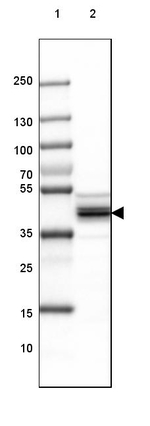 SUCLA2 Antibody in Western Blot (WB)