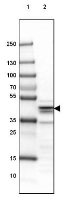 SUCLA2 Antibody in Western Blot (WB)