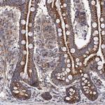 SUCLA2 Polyclonal Antibody