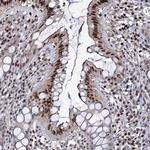 SMCHD1 Antibody in Immunohistochemistry (Paraffin) (IHC (P))