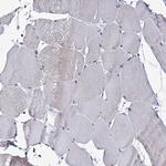 SMCHD1 Antibody in Immunohistochemistry (Paraffin) (IHC (P))