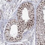 SMCHD1 Antibody in Immunohistochemistry (Paraffin) (IHC (P))